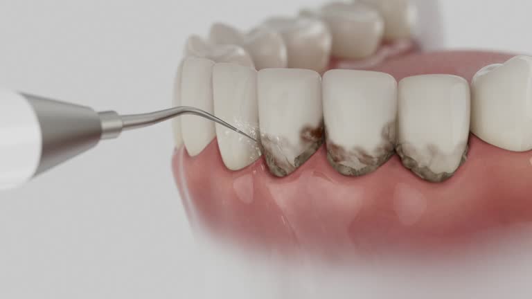 Trusted Dental Implants service in Doral, FL - Dentist Open Now